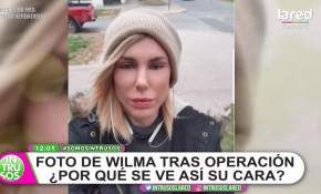 Wilma González respondió a las críticas por su rinoplastía: "Me da pena" [FOTOS]